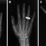 Astronauts Successfully Capture X-Ray Images in Space for the First Time