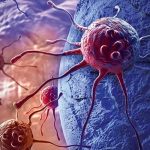 World Head and Neck Cancer Day: How Can the Rising Risk Among Young Adults Be Prevented?
