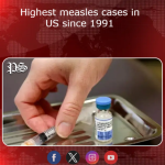 Highest measles cases in US since 1991